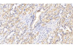 Immunohistochemistry (IHC) image for anti-Interleukin 1 Receptor Antagonist (IL1RN) (AA 26-177) antibody (ABIN7428806)