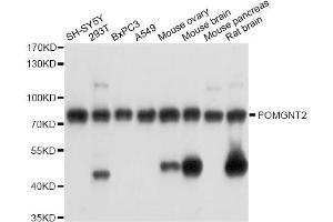 Western blot analysis of extracts of various cell lines, using POMGNT2 antibody (ABIN6289951) at 1:3000 dilution. (C3orf39 Antikörper)
