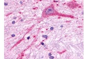 Immunohistochemical staining of Brain (Neurons) using anti- MCHR2 antibody ABIN122241