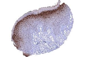 Skin In the skin a nuclear and cytoplasmic Cystatin A immunostaining is predominantly seen in the granular cell layer. (CSTA Antikörper)