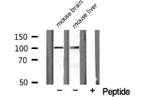 Western blot analysis on HuvEc cell lysate using NARG1 Antibody (NAA15 Antikörper  (Internal Region))
