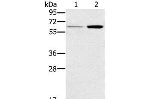 Western Blot analysis of Human liver and Mouse kidney tissue using TNFRSF11A Polyclonal Antibody at dilution of 1:200 (TNFRSF11A Antikörper)