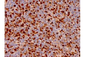 Immunohistochemistry (IHC) image for anti-Annexin A1 (ANXA1) antibody (ABIN6939608)