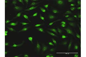 Immunofluorescence (IF) image for anti-Phosphate Cytidylyltransferase 1, Choline, alpha (PCYT1A) (AA 2-90) antibody (ABIN518715)