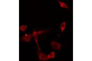 ABIN6275430 staining  HepG2 cells by IF/ICC. (PDK2 Antikörper  (Internal Region))