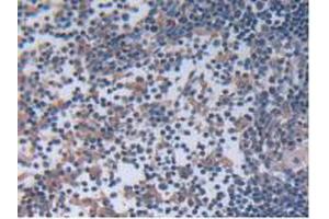 IHC-P analysis of Rat Lymph Node Tissue, with DAB staining. (IL12A Antikörper  (AA 23-215))