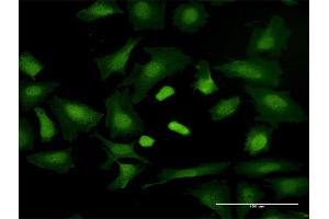 Immunofluorescence of purified MaxPab antibody to TRGV3 on HeLa cell.