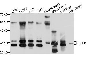 Western blot analysis of extracts of various cell lines, using GJB1 antibody (ABIN6003810) at 1/1000 dilution. (GJB1 Antikörper)