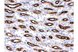 IHC testing of FFPE mouse kidney with SLC12A1 antibody. (SLC12A1 Antikörper)