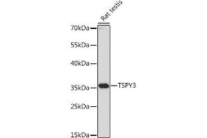 Western blot analysis of extracts of Rat testis, using TSPY3 antibody (ABIN7270776) at 1:1000 dilution. (TSPY3 Antikörper  (AA 1-308))