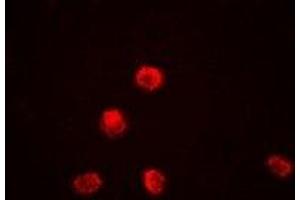 Immunofluorescence (IF) image for anti-Lysine (K)-Specific Demethylase 1A (KDM1A) antibody (ABIN7307960)