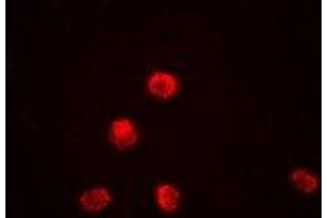 Immunofluorescent analysis of KDM1A staining in Jurkat cells.