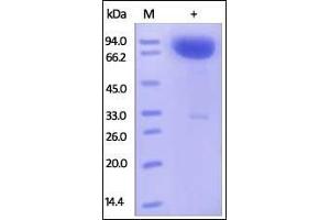 Human SIRP alpha, mouse IgG1 Fc Tag (HPLC-verified) on SDS-PAGE under reducing (R) condition.