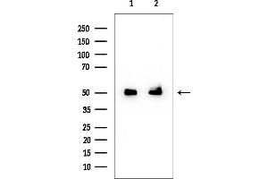 Western blot analysis of lysates from various samples, using SEPT6 Mouse Monoclonal Antibody at 1/1000 dilution.