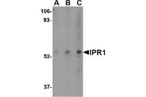 Western blot analysis of IPR1 in Hela cell lysate with IPR1 antibody at (A) 0. (SP110 Antikörper  (C-Term))