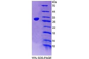 SDS-PAGE analysis of Rat NXF1 Protein. (NXF1 Protein)