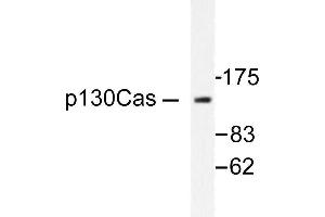 Image no. 1 for anti-Breast Cancer Anti-Estrogen Resistance 1 (BCAR1) antibody (ABIN271903) (BCAR1 Antikörper)