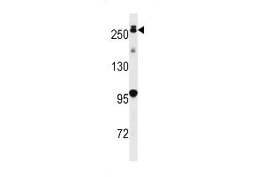 LRRK2 antibody  (AA 930-961)