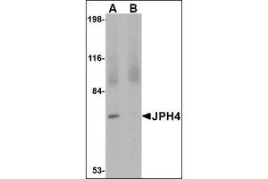 Western blot analysis of JPH4 in 293 cell lysate with this product at 1 μg/ml in (A) the absence and (B) the presence of blocking peptide. (Junctophilin 4 Antikörper  (C-Term))