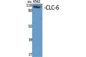 Western Blot (WB) analysis of specific cells using CLC-6 Polyclonal Antibody. (CLCN6 Antikörper  (Internal Region))