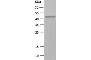 Western Blotting (WB) image for Mitogen-Activated Protein Kinase Kinase 2 (MAP2K2) (AA 1-400) protein (His tag) (ABIN7123999) (MEK2 Protein (AA 1-400) (His tag))