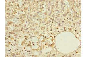 Immunohistochemistry of paraffin-embedded human adrenal gland tissue using ABIN7144926 at dilution of 1:100 (ABCF3 Antikörper  (AA 201-500))