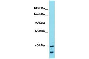 Western Blotting (WB) image for anti-MYCBP Associated Protein (MYCBPAP) (N-Term) antibody (ABIN2774232)