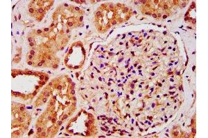 IHC image of ABIN7157138 diluted at 1:200 and staining in paraffin-embedded human kidney tissue performed on a Leica BondTM system. (IST1 Antikörper  (AA 172-284))