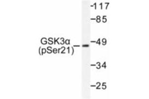 Image no. 1 for anti-Glycogen Synthase Kinase 3 alpha (GSK3a) (pSer21) antibody (ABIN318029) (GSK3 alpha Antikörper  (pSer21))
