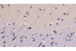 Immunohistochemistry (IHC) image for anti-BCL2-Like 1 (BCL2L1) (AA 2-212) antibody (ABIN7437179)