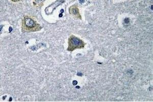 Image no. 2 for anti-Carbonic Anhydrase VB, Mitochondrial (CA5B) antibody (ABIN317824) (CA5B Antikörper)