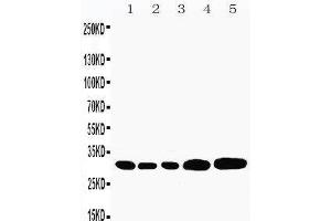 Anti-Caspase-3(P10) antibody,  Western blotting Lane 1: Rat Liver Tissue Lysate Lane 2: Rat Thymus Tissue Lysate Lane 3: Rat Spleen Tissue Lysate Lane 4: HEPA Cell Lysate Lane 5: NEURO Cell Lysate