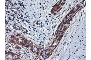 Image no. 1 for anti-Histidyl-tRNA Synthetase 2, Mitochondrial (Putative) (HARS2) antibody (ABIN1498585) (HARS2 Antikörper)