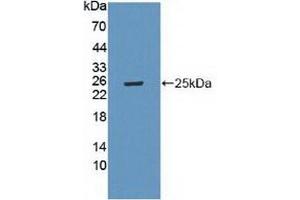 Detection of Recombinant LAMa4, Mouse using Polyclonal Antibody to Laminin Alpha 4 (LAMa4) (LAMa4 Antikörper  (AA 745-940))