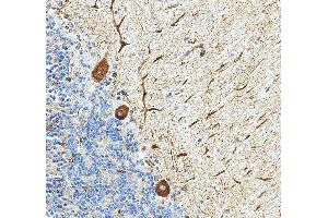 IHC analysis of PAK5/PAK7 using anti-PAK5/PAK7 antibody (ABIN3043895).
