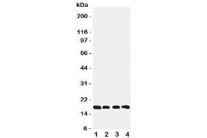 Western blot testing of Cyclophilin B antibody and Lane 1:  rat ovary (PPIB Antikörper  (C-Term))