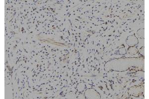 ABIN6277776 at 1/100 staining Human gastric tissue by IHC-P. (HES1 Antikörper  (Internal Region))