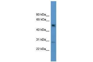 Western Blotting (WB) image for anti-Protein Phosphatase 2, Regulatory Subunit B, gamma (PPP2R2C) (N-Term) antibody (ABIN2787392)