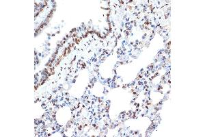 Immunohistochemistry of paraffin-embedded rat lung using Histone H2A Rabbit mAb (ABIN7267703) at dilution of 1:100 (40x lens). (HIST1H2AE Antikörper)