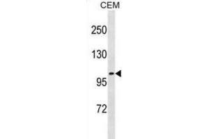 Western Blotting (WB) image for anti-Unc-5 Homolog C (C. Elegans) (Unc5c) antibody (ABIN3001210) (Unc5c Antikörper)