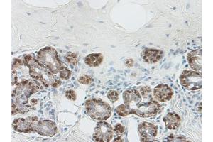 Formalin-Fixed Paraffin-Embedded Sections of Human breast lobular carcinoma in situ using Maspin Antibody Cat.