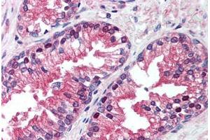 Human Prostate (formalin-fixed, paraffin-embedded) stained with VCP antibody ABIN239859 at 5 ug/ml followed by biotinylated anti-mouse IgG secondary antibody ABIN481714, alkaline phosphatase-streptavidin and chromogen. (VCP Antikörper)