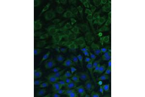 Immunofluorescence analysis of C6 cells using Oncostatin M antibody (ABIN6128404, ABIN6145072, ABIN6145073 and ABIN6221768) at dilution of 1:100. (Oncostatin M Antikörper  (AA 26-252))