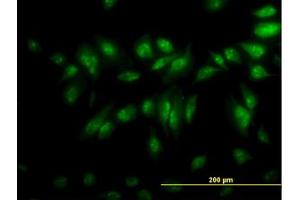 Image no. 4 for anti-CLK3 (CLK3) (AA 36-136) antibody (ABIN598615) (CLK3 Antikörper  (AA 36-136))