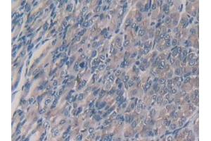 Immunohistochemistry (IHC) image for anti-Colony Stimulating Factor 1 (Macrophage) (CSF1) (AA 33-204) antibody (ABIN7430927)