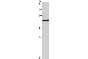 Western Blotting (WB) image for anti-Interleukin 5 Receptor, alpha (IL5RA) antibody (ABIN5546745) (IL5RA Antikörper)
