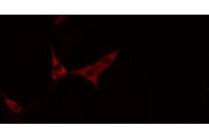 ABIN6269377 staining NIH-3T3 cells by IF/ICC. (TRKB Antikörper  (C-Term))