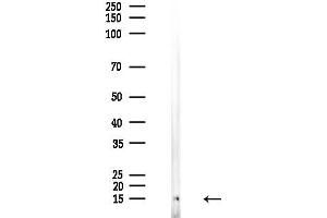 Western blot analysis of lysates from EC304 cells, using Tri-Methyl-Histone H3 (Lys4)/H3K4me3 Antibody at 1/1000 dilution.