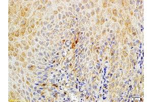 Immunohistochemistry (Paraffin-embedded Sections) (IHC (p)) image for anti-Suppression of Tumorigenicity 14 (ST14) (AA 11-100) antibody (ABIN669726)