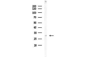 Western blot analysis of lysates from EC304 cells, using GFR Antibody at 1/1000 dilution.
